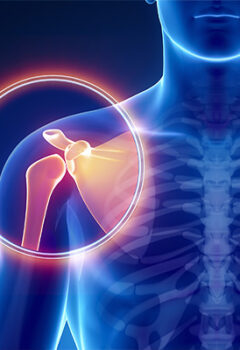 Articulación Acromio-Clavicular