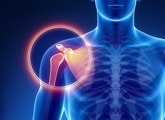 Articulación Acromio-Clavicular